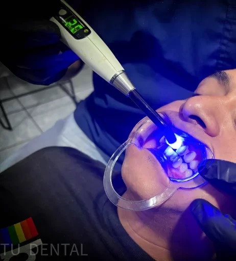 Paciente en procedimiento dental con luz LED azul en consultorio de Tú Dental